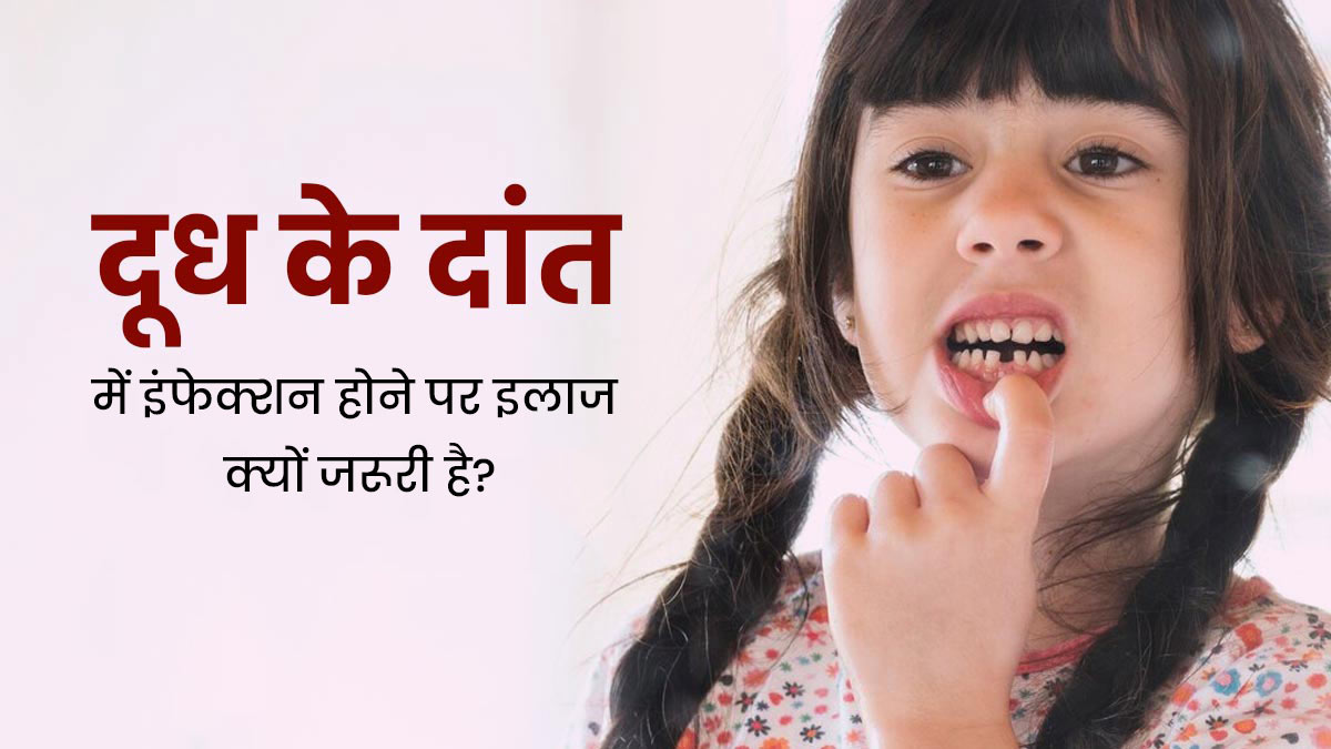 दूध के दांत में इंफेक्शन होने पर न करें लापरवाही, मसूड़ों को भी हो सकता है नुकसान