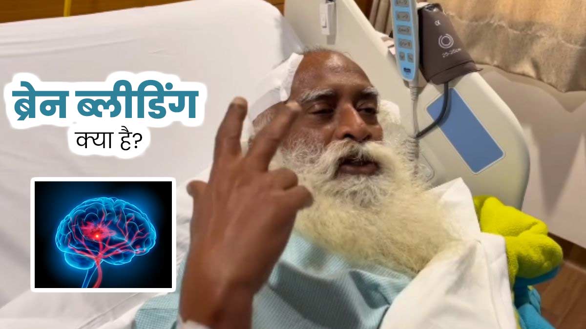 Brain Bleeding क्या है? जिसके चलते सद्गुरु जग्गी वासुदेव को करानी पड़ी सर्जरी, जानें इसके लक्षण और कारण