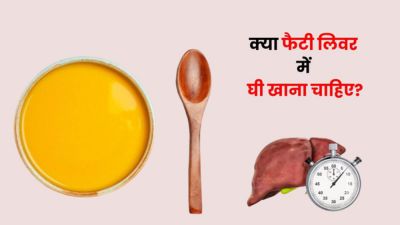 फैटी लिवर में घी खाना चाहिए या नहीं? जानें डाइटिशियन से