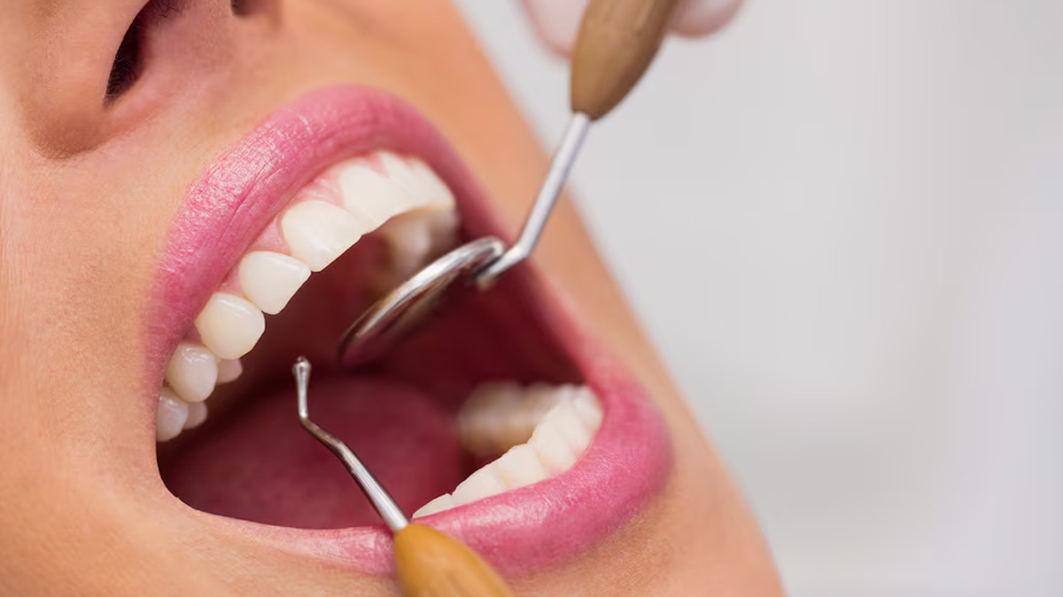 tooth-polishing