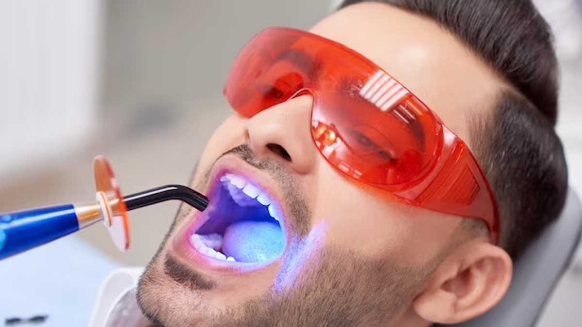 tooth-whitening