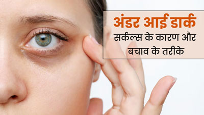 आंखों के नीचे काले घेरे क्यों हो जाते हैं? डॉक्टर से जानें कारण और बचाव के तरीके 