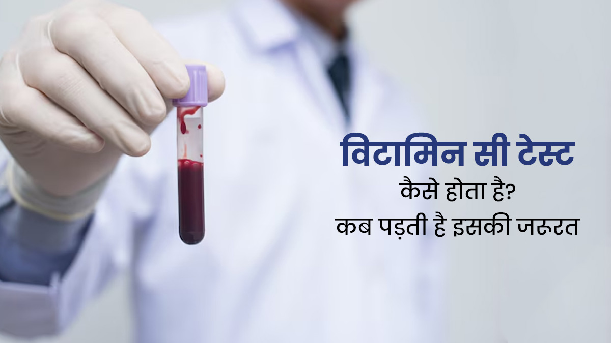 विटामिन सी टेस्ट कैसे होता है? जानें कब पड़ती है इसकी जरूरत