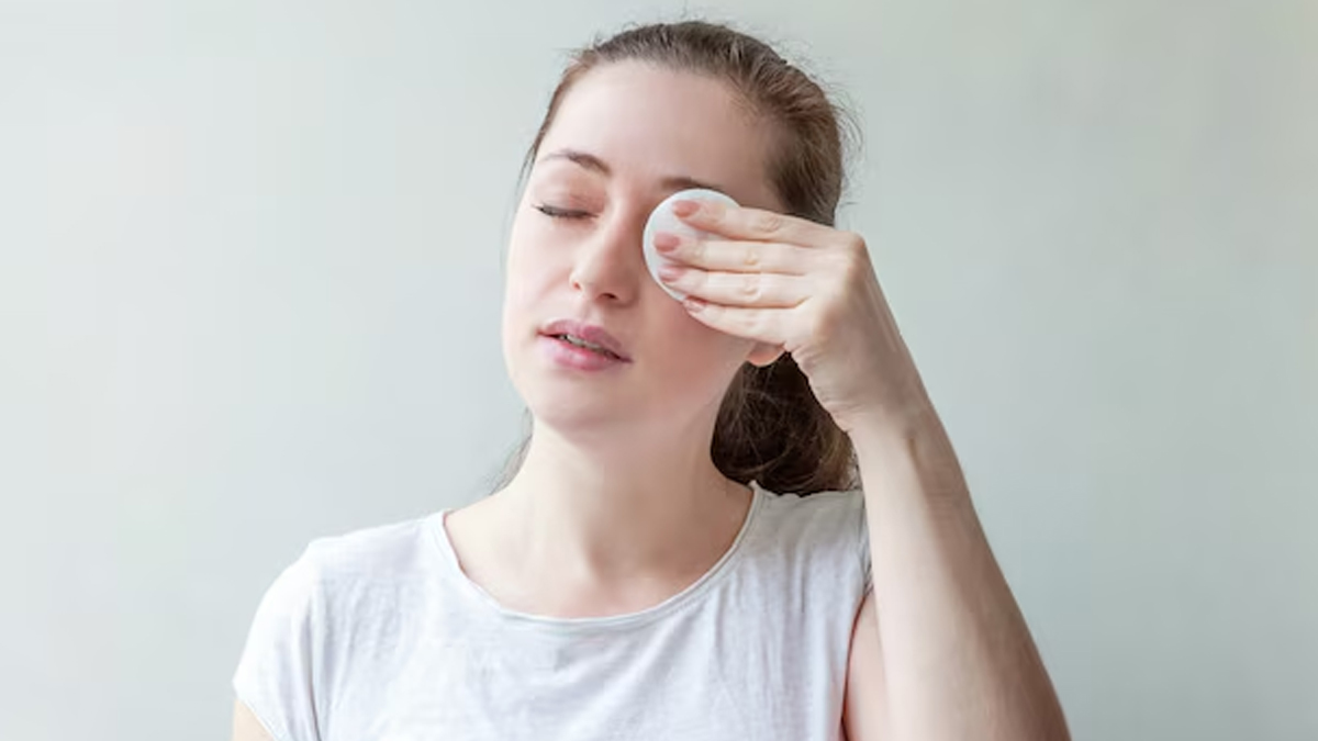 Troubled With A Stye? Try These Effective Home Remedies To Speed Up The 