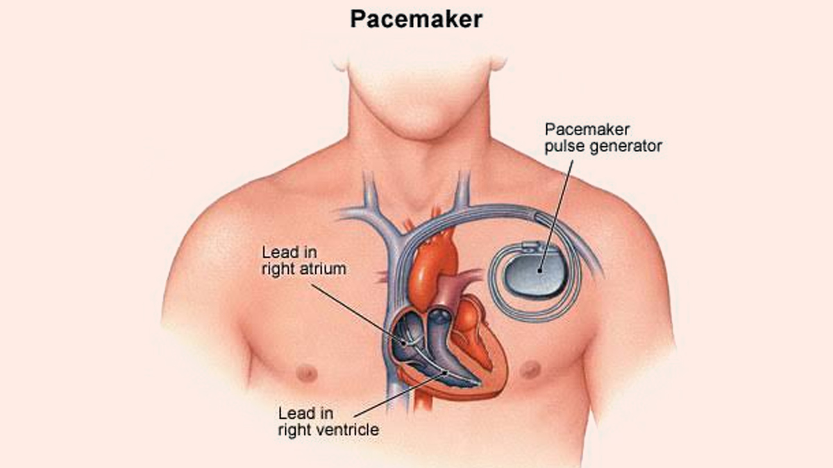Arnold Schwazenegger