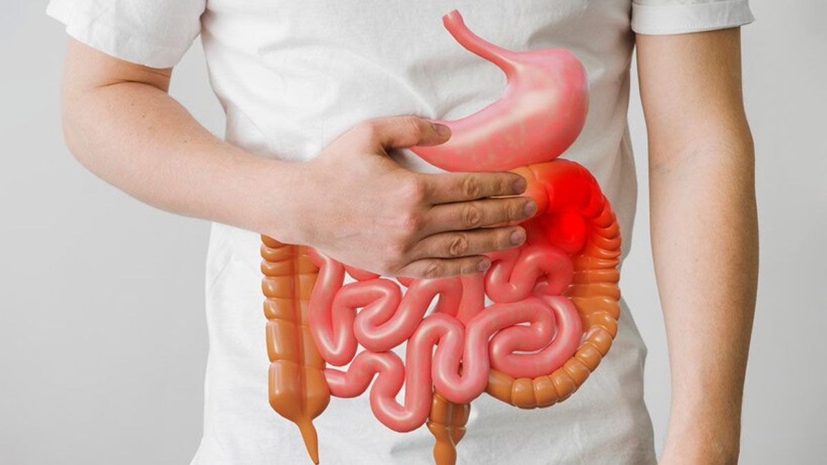 Foods To Avoid If You're Diagnosed With Stomach Ulcer