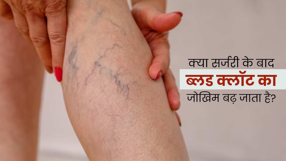 क्या सर्जरी के बाद रक्त के थक्के (blood Clots) बन सकते हैं? डॉक्टर से जानें