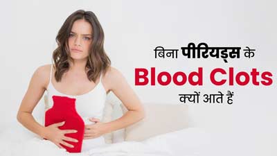 बिना पीरियड्स के ब्लड क्लॉट क्यों आते हैं? डॉक्टर से जानें 5 कारण