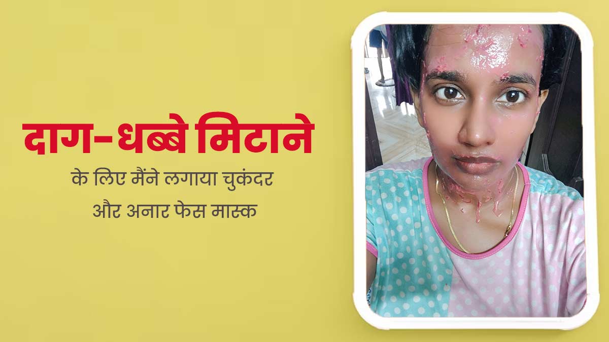 डिलीवरी के बाद चेहरे के दाग-धब्बे मिटाने के लिए मैंने लगाया चुकंदर और अनार का फेस मास्क, आप भी करें ट्राई