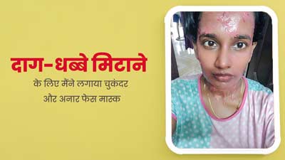 डिलीवरी के बाद चेहरे के दाग-धब्बे मिटाने के लिए मैंने लगाया चुकंदर और अनार का फेस मास्क, आप भी करें ट्राई