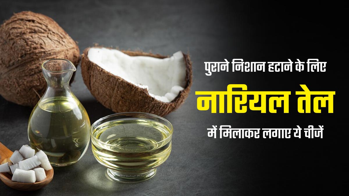 चोट के पुराने निशान हटाने के लिए नारियल तेल में मिलाकर लगाएं ये 5 चीजें, जल्द दिखेगा असर
