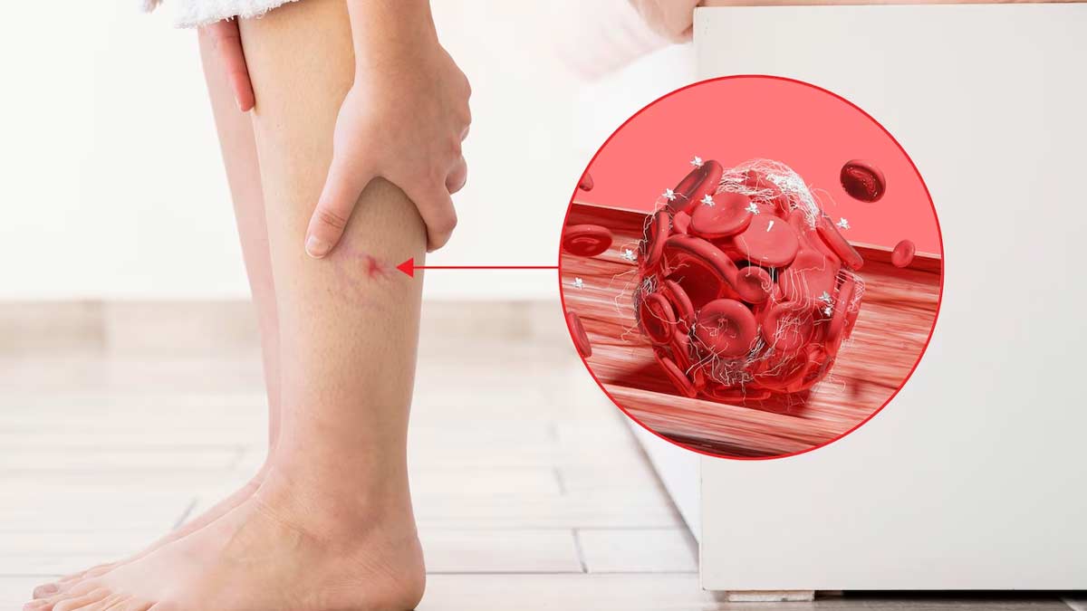 prevent blood clotting after surgery