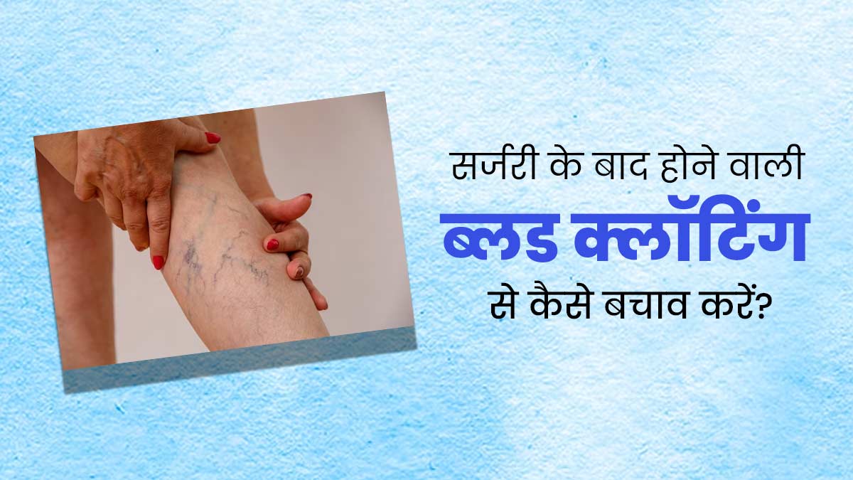 सर्जरी के बाद ब्लड क्लॉटिंग से बचने के लिए क्या करें? जानें खास टिप्स