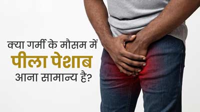 क्या गर्मी के मौसम में पीला पेशाब आना सामान्य है? जानें क्या कहते हैं डॉक्टर