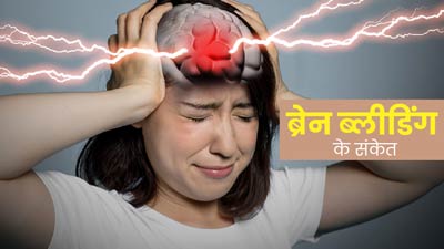 Brain Bleeding: ब्रेन ब्लीडिंग होने पर नजर आते हैं ये 5 चेतावनी संकेत, न करें नजरअंदाज