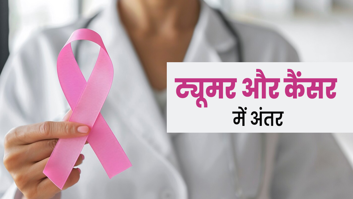 ट्यूमर और कैंसर में क्या अंतर होता है? डॉक्टर से जानें इनके लक्षण