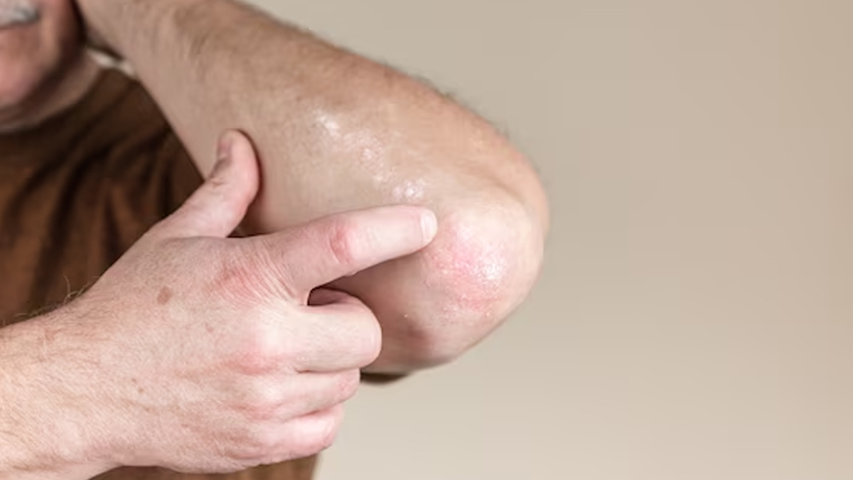 elbow itching in hindi