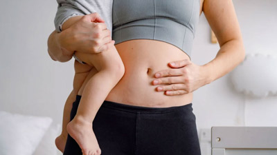 पेट का फैलना (डायस्टेसिस रेक्टी) क्या है? डॉक्टर से जानें 30-40 की उम्र में इससे राहत पाने के तरीके 