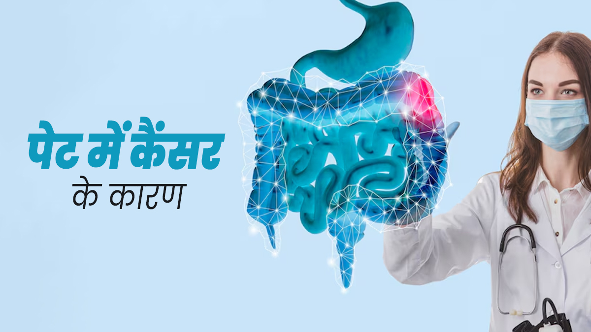 Stomach Cancer Causes: पेट में कैंसर क्यों होता है? डॉक्टर से जानें इसके कारण 