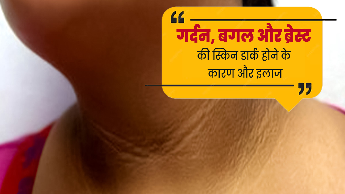  गर्दन, बगल और ब्रेस्ट की स्किन डार्क होने के पीछे हो सकते हैं ये कारण, जानें इसका इलाज