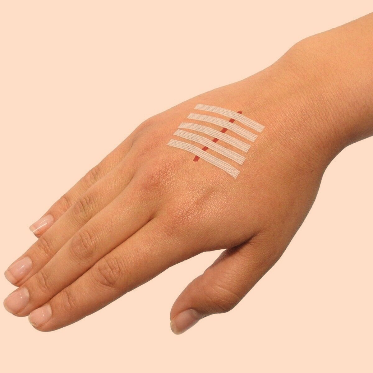 butterfly bandage usage 