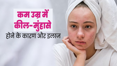 25-30 की उम्र के बाद भी चेहरे पर हो रहे हैं कील-मुंहासे? जानें Adult Acne का कारण और इलाज