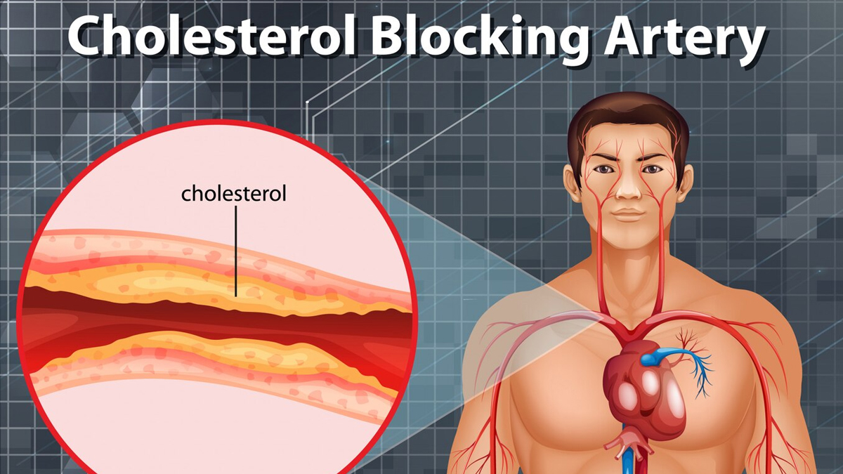 What Is Cholesterol In Hindi