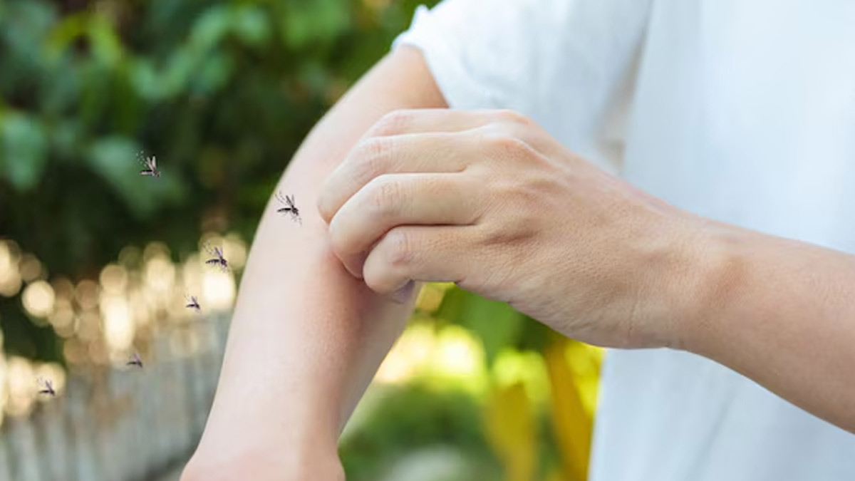 How Long After A Mosquito Bite Can You Develop Dengue? | OnlyMyHealth