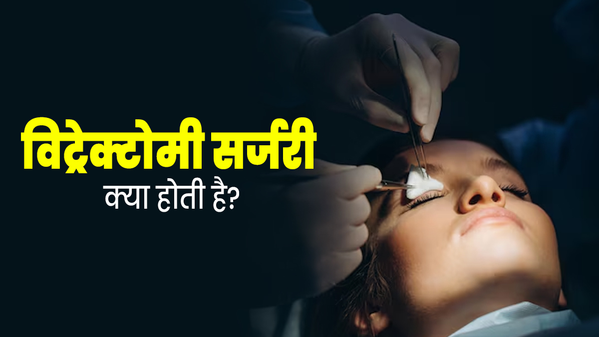 जानें क्या होती है विट्रोक्टोमी सर्जरी? डॉक्टरों से समझें इसके बारे में