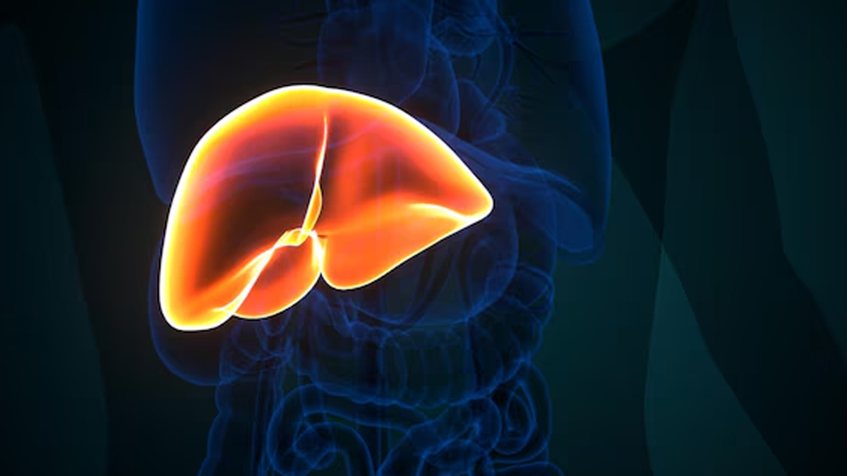 How To Reverse Fatty Liver Naturally? Here Are Some Easy Steps You Can Practice At Home