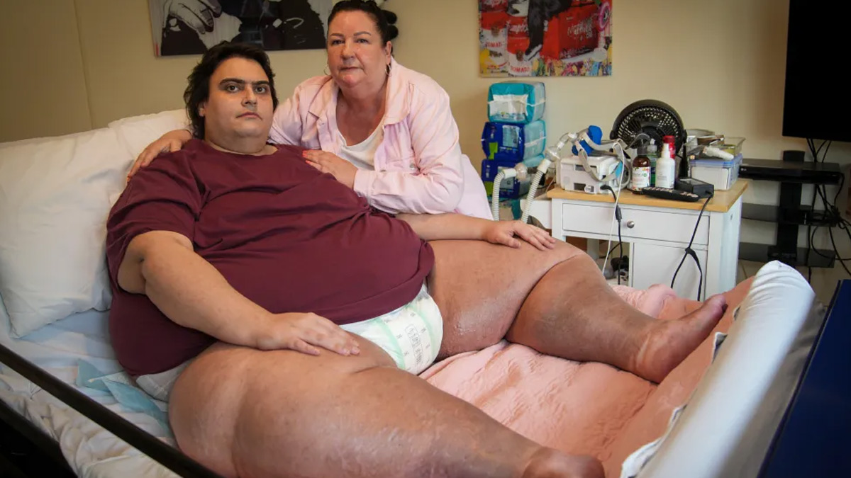 UK’s Fattest Man Dies Of Organ Failure: Here's How Obesity May Cause Organ Failure
