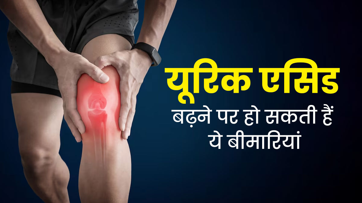 यूरिक एसिड बढ़ने पर आप हो सकते हैं इन 5 गंभीर बीमारियों के शिकार, जानें बचाव