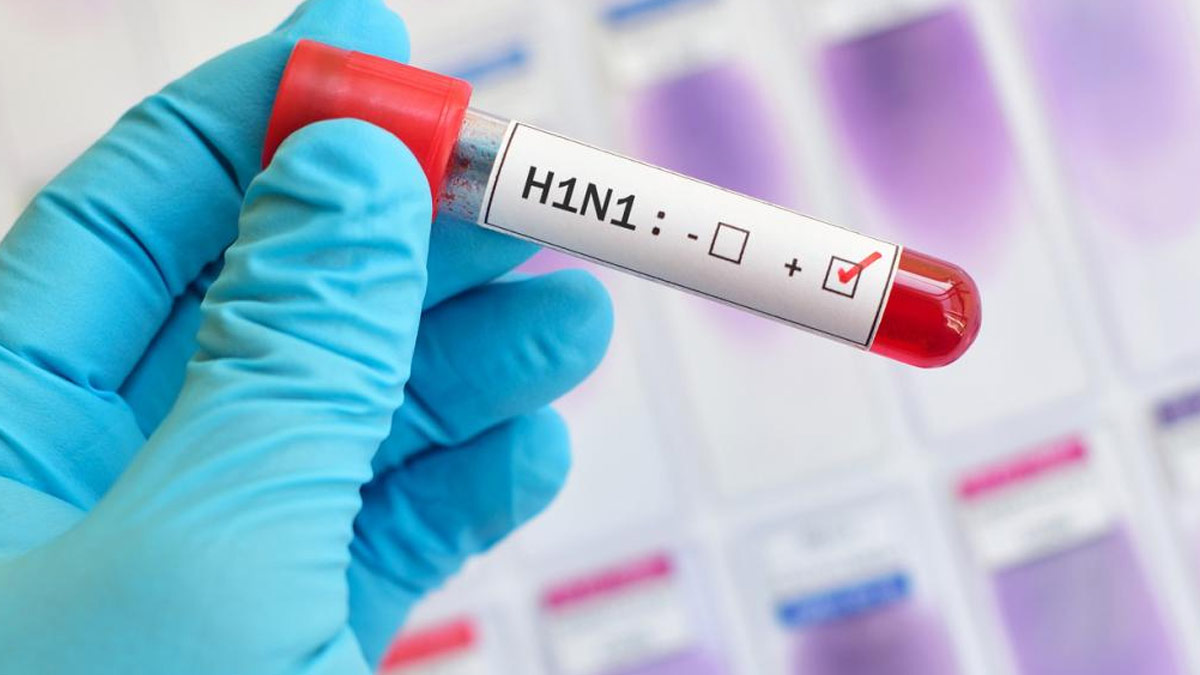 Swine Flu: राजस्थान में तेजी से बढ़े स्वाइन फ्लू के मामले, अप्रैल में हुई एक हजार से ज्यादा मामलों की पुष्टि