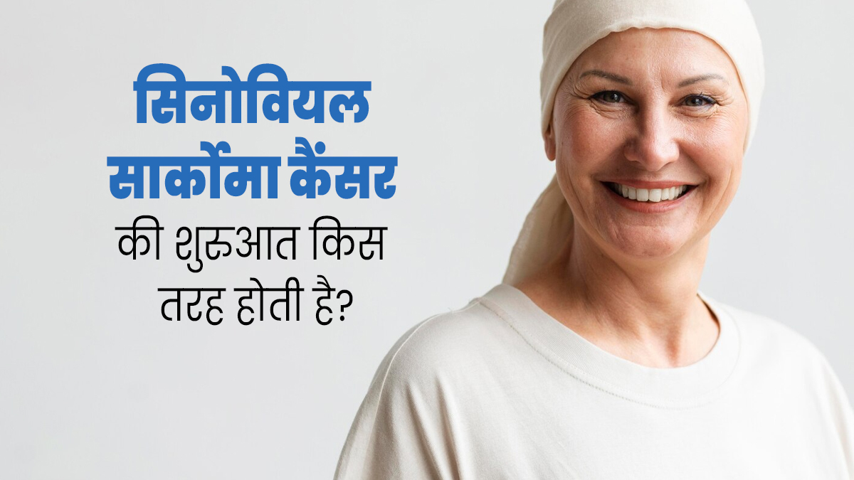 शरीर में सिनोवियल सार्कोमा कैंसर की शुरुआत कैसे होती है? डॉक्टर से जानें 