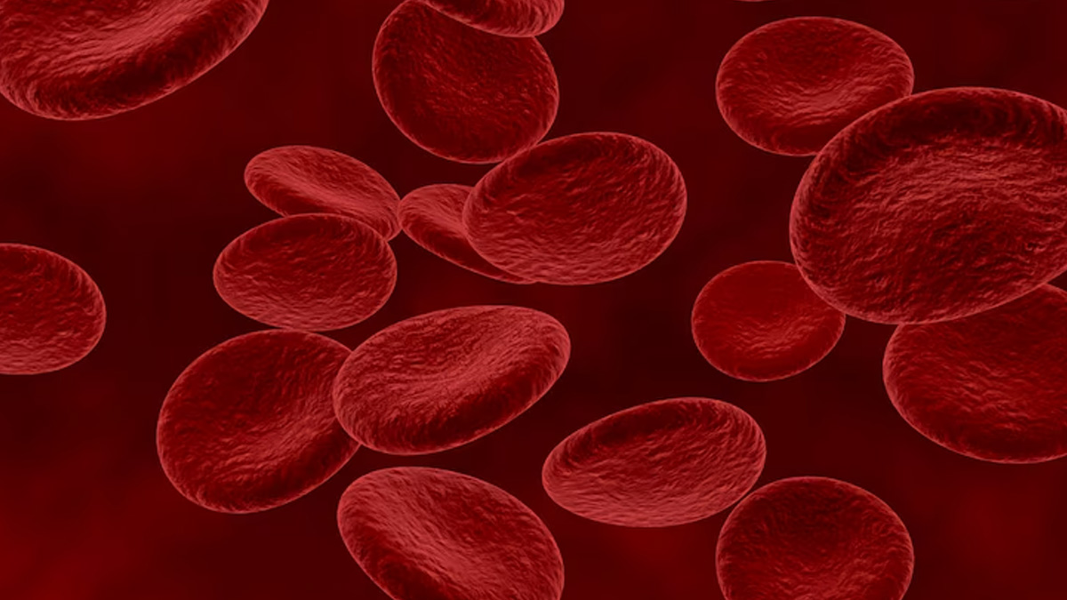 thalassemia