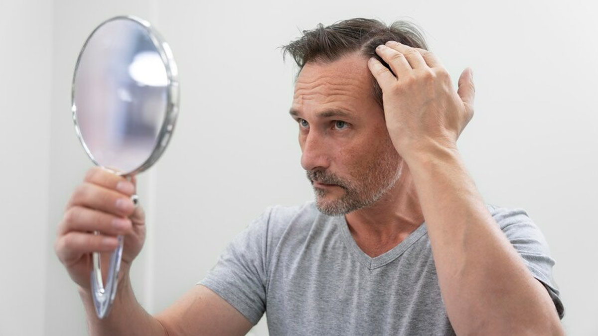 Beat the Heat: How To Take Extra Care of Your Hair Regrowth After Transplantation In Summer
