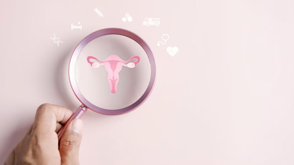 Ovarian Cancer: How To Detect The Disease Early If You have No Symptoms