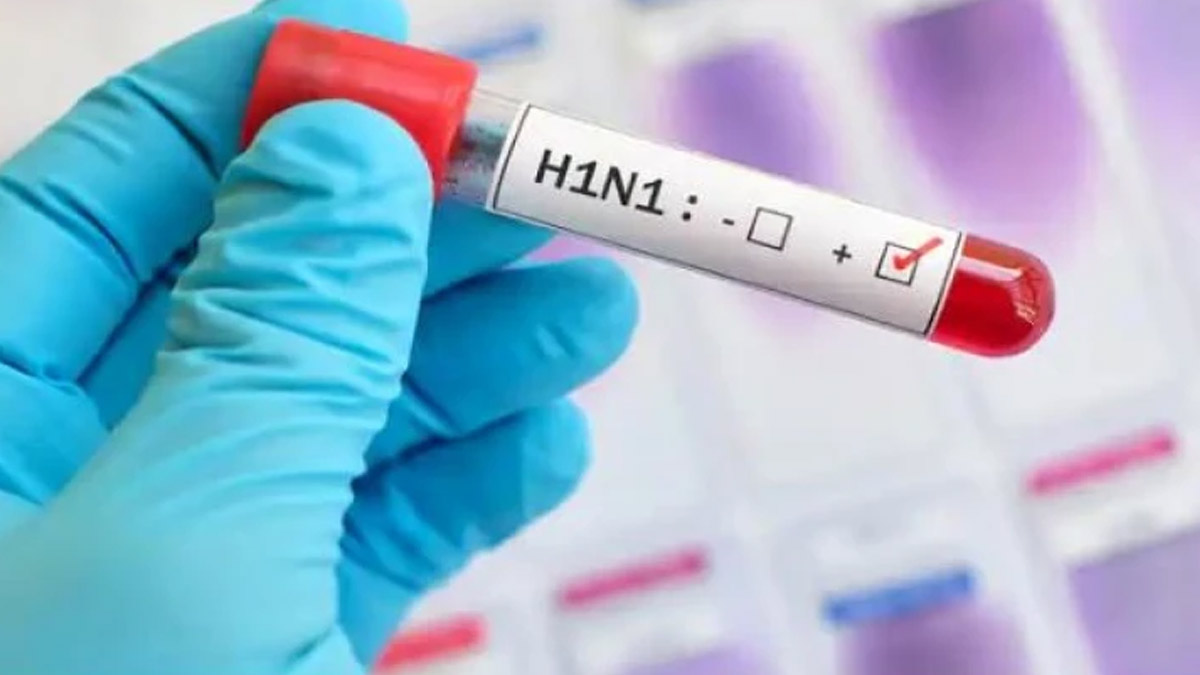 Swine Flu Outbreak In Assam; Symptoms To Look Out For