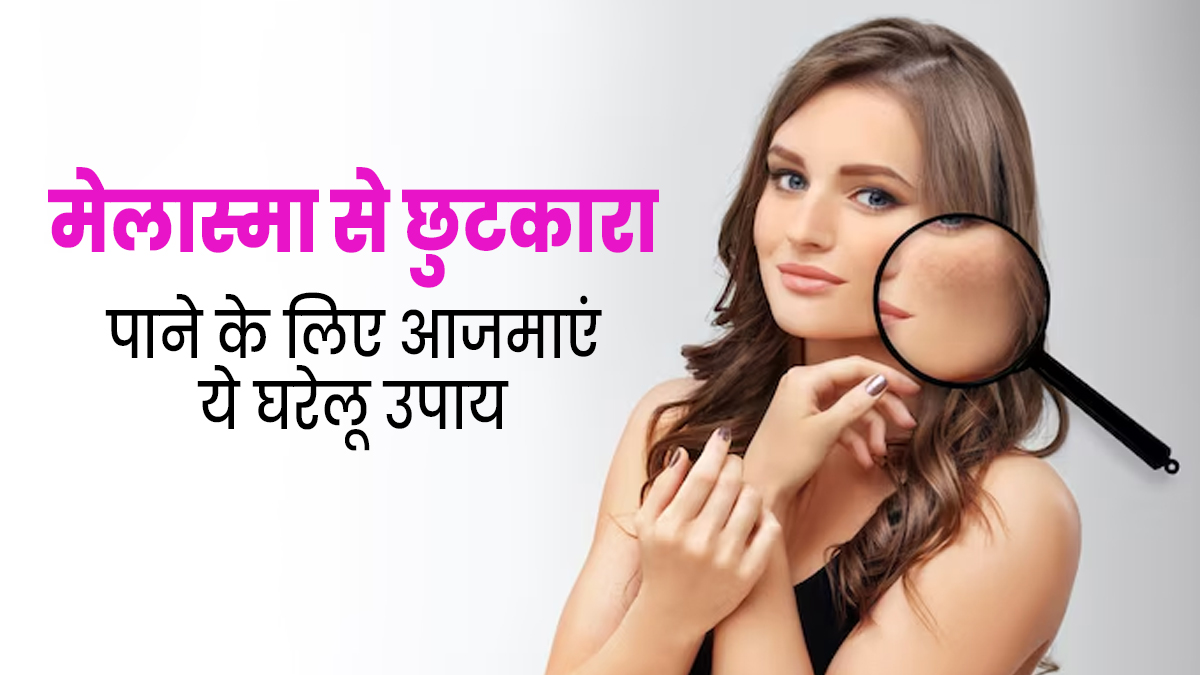 Melasma Home Remedies: मेलास्मा (काले धब्बे) से छुटकारा पाने के लिए आजमाएं ये 3 घरेलू उपाय