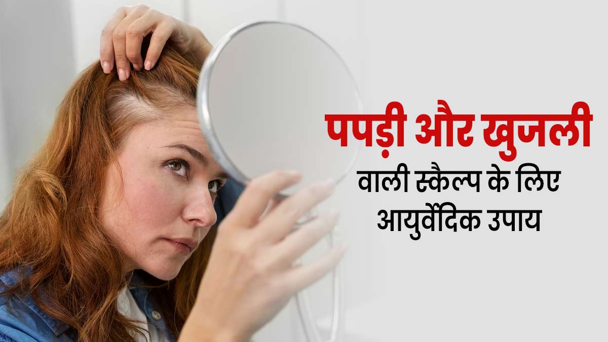 गर्मियों में सिर में जमी पपड़ी और खुजली से हैं परेशान, तो आजमाएं ये आयुर्वेदिक उपाय