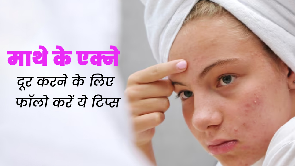 माथे पर होने वाले एक्ने से हैं परेशान, तो जानें इसके कारण और बचाव के तरीके