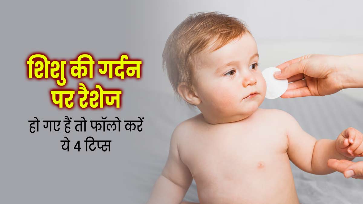 शिशु की गर्दन पर रैशेज हो गए हैं तो फॉलो करें ये 5 टिप्स, जलन से भी मिलेगी राहत