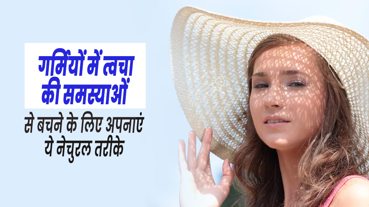 गर्मियों में त्वचा संबंधी समस्याओं से बचने के लिए अपनाएं ये नेचुरल तरीके, मिलेगा फायदा