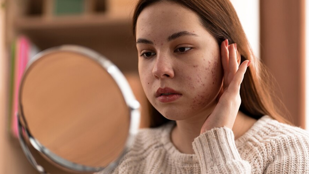 skin-self-exam