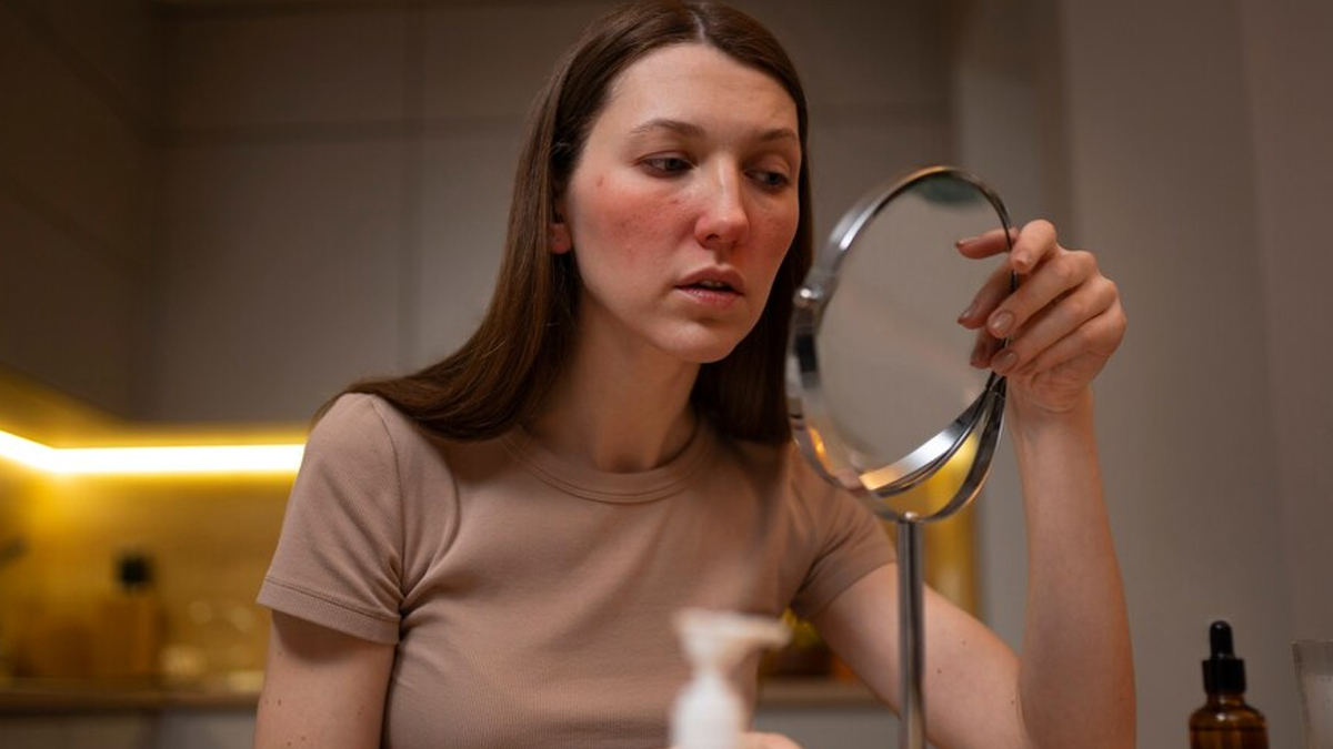 skin-irritation