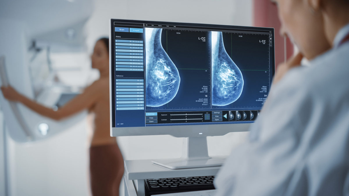 Breast Cancer: When Should Women Start Getting Annual Mammograms?