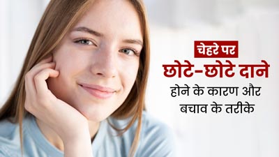 चेहरे पर हो गए हैं छोटे-छोटे दाने? जानें इसके कारण और बचाव के तरीके
