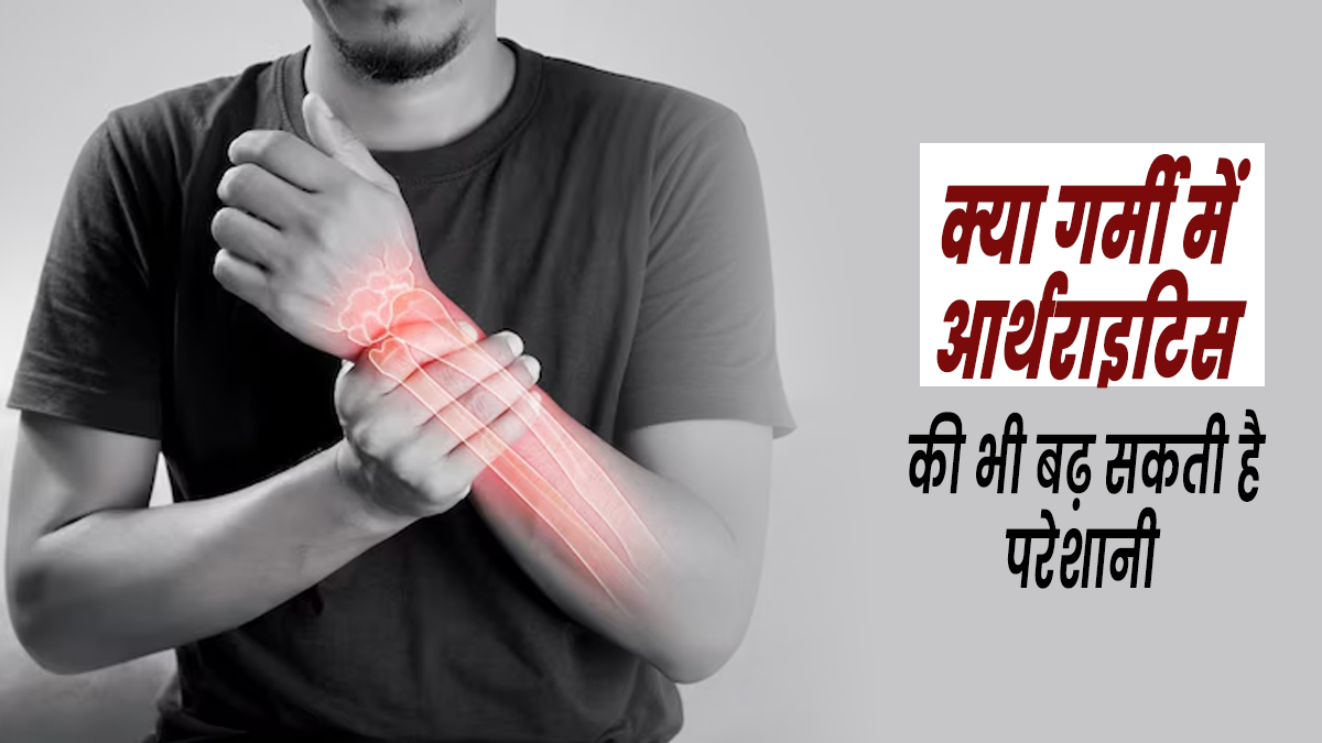 क्या गर्मी की वजह से भी बढ़ सकती है अर्थराइटिस के मरीजों की समस्या? डॉक्टर से जानें बचाव के उपाय