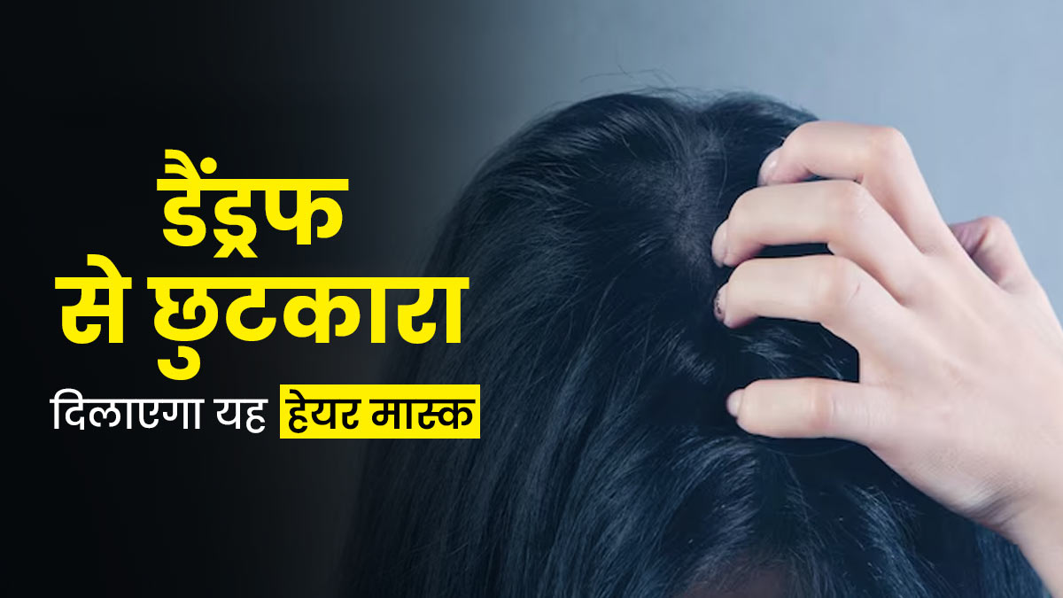 डैंड्रफ के लिए आजमाएं नीम और एप्‍पल साइडर व‍िनेगर से बना यह हेयर मास्क, जानें बनाने और लगाने का तरीका