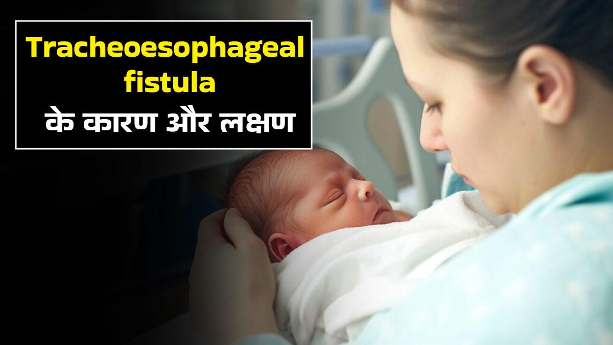 Tracheoesophageal fistula: नवजात शिशुओं में क्यों होती है ट्रेकियोइसोफेगल फिस्टुला की समस्या? जानें इसके लक्षण